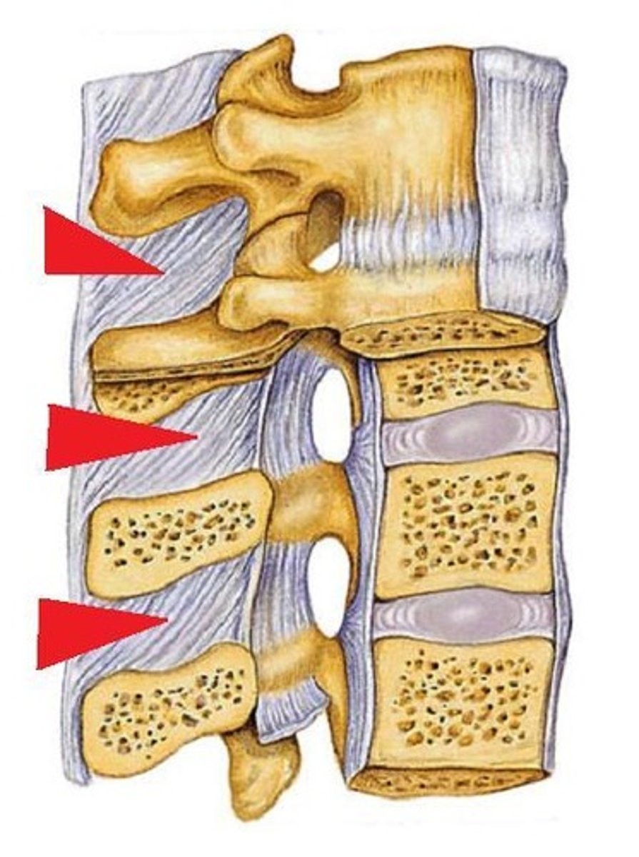 <p>connects the spinous processes of adjacent vertebrae</p><p>*taut in flexion, slack extension</p>