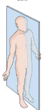 <p>What body plane is this?</p>