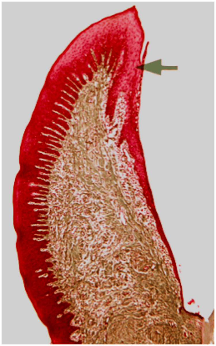 <p><em>identify the mucosa</em></p>