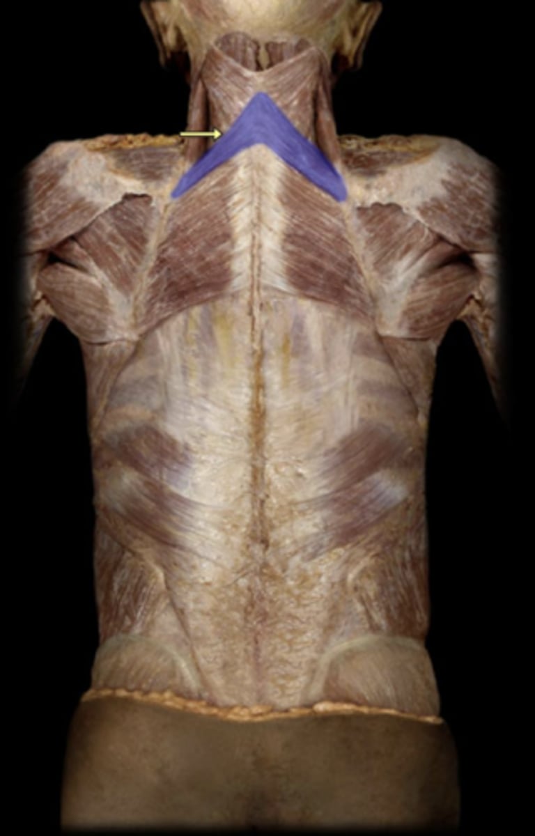 <p>action of rhomboid minor</p>
