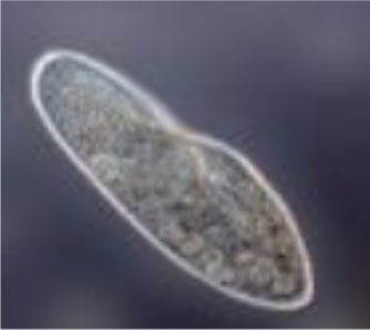 <p>What is this (classification of protozoa based on locomotion structure)</p>