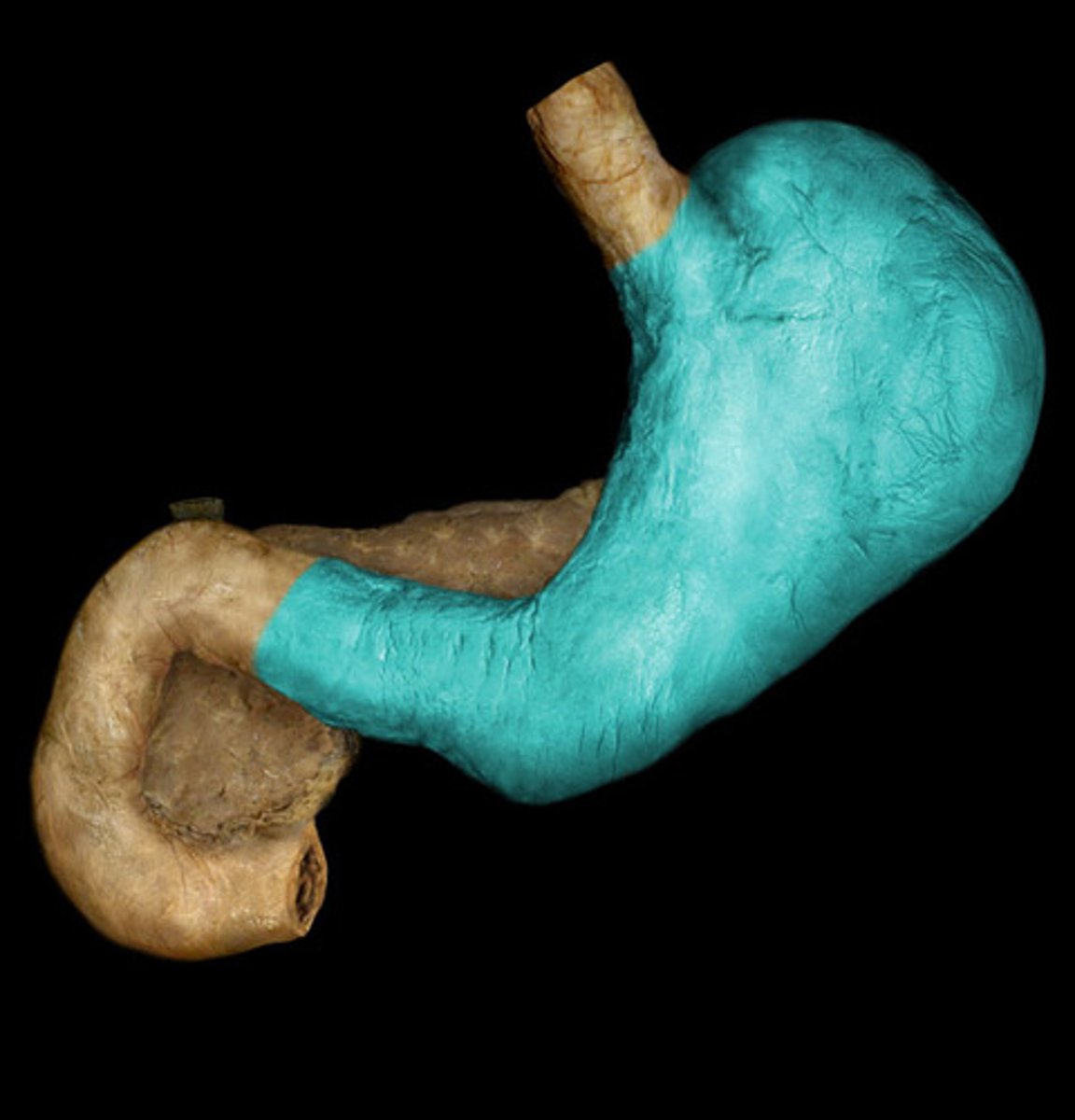 <p>what is highlighted in this image?</p>