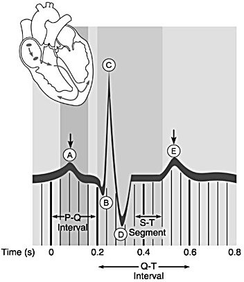 <p>Ventricular repolarization.</p>