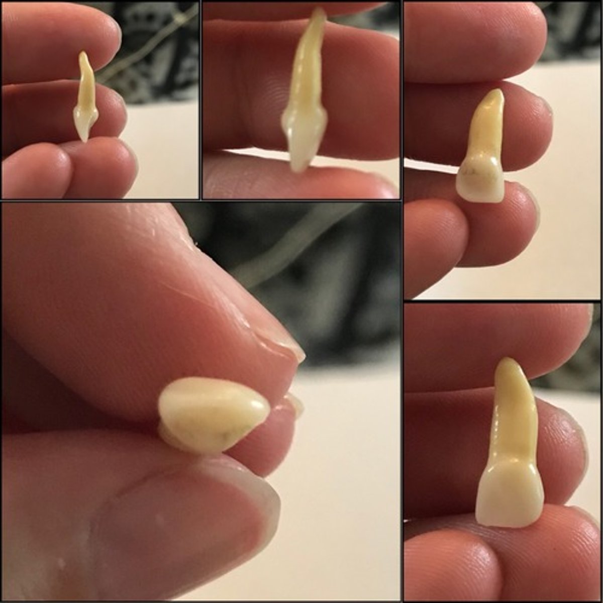 <p>What tooth is this ?</p>