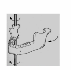 <p>Mandibular movement occurs around the frontal axis when one condyle moves anteriorly out of terminal hinge position with the vertical axis of opposite condyle remaining.</p>