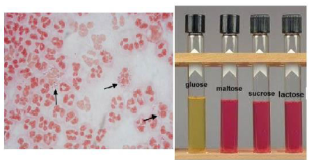 <p>What is the infection caused by this organism to newborns delivered from an infected birth canal?</p>