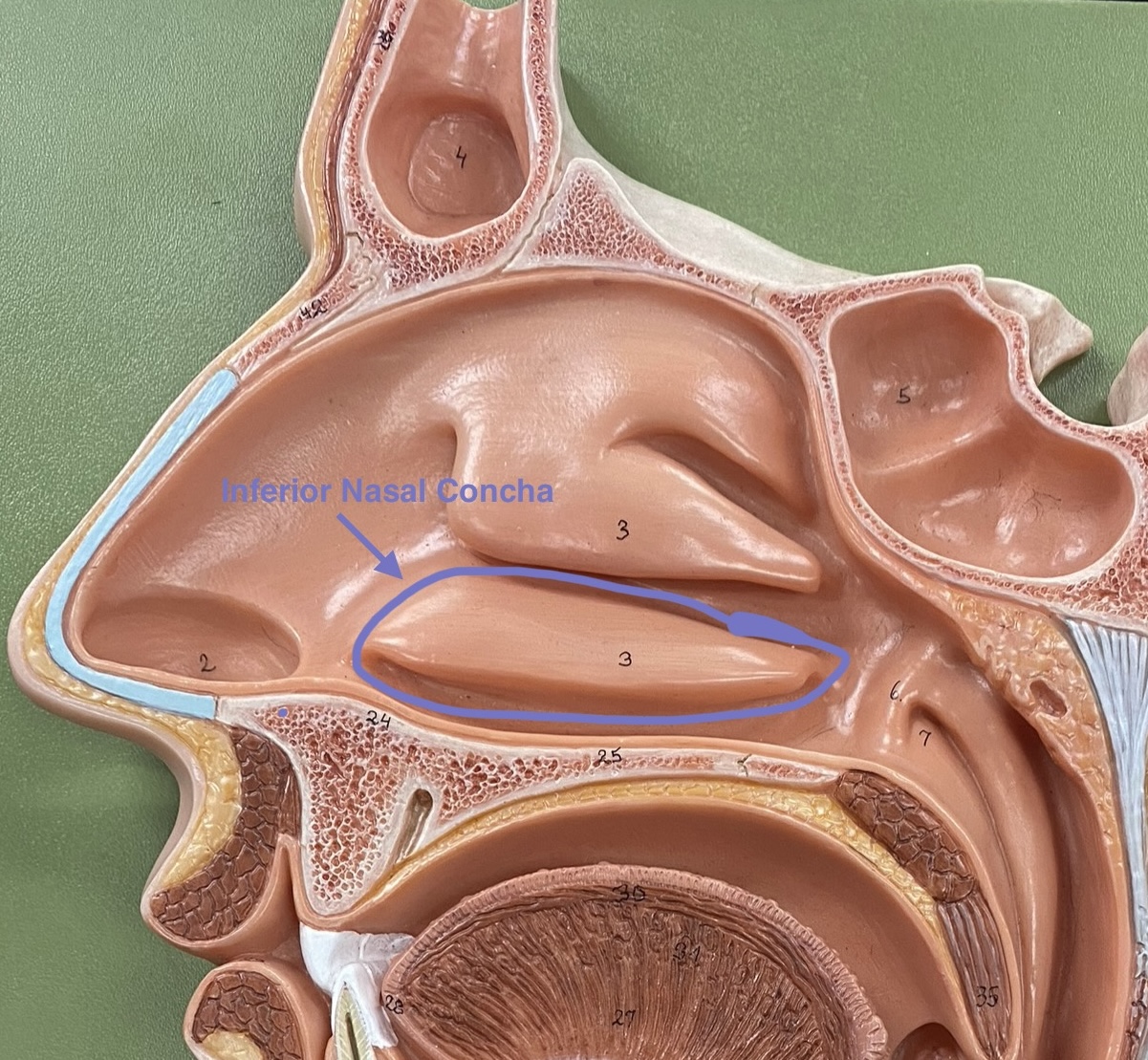 <p>Makes the airflow turbulent and thee surfaces are mucus which traps particles to stop them from going down the trachea</p>