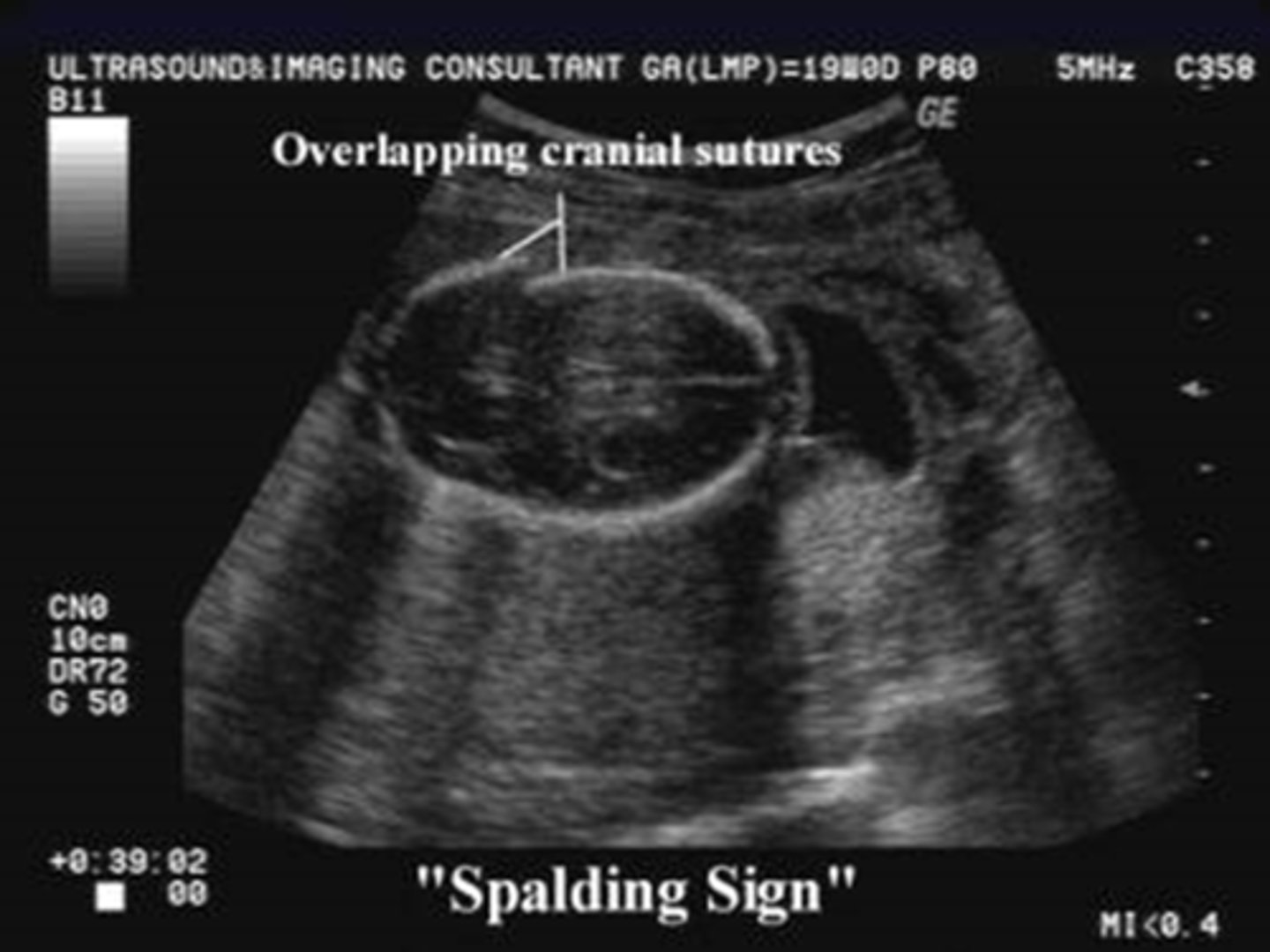 <p>Spalding sign</p>