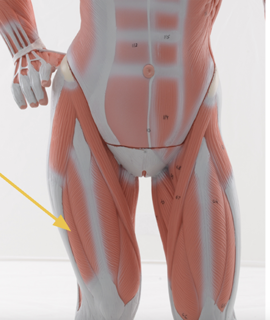 <p>vastus lateralis m.</p><p>O: greater trochanter of femur</p><p>I: patella, tibial tuberosity&nbsp;</p><p>Action(s): knee extension</p><p>Innervated by femoral nerve</p><p>*note: when plastinated structure flipped, vastus medialis can be seen </p>