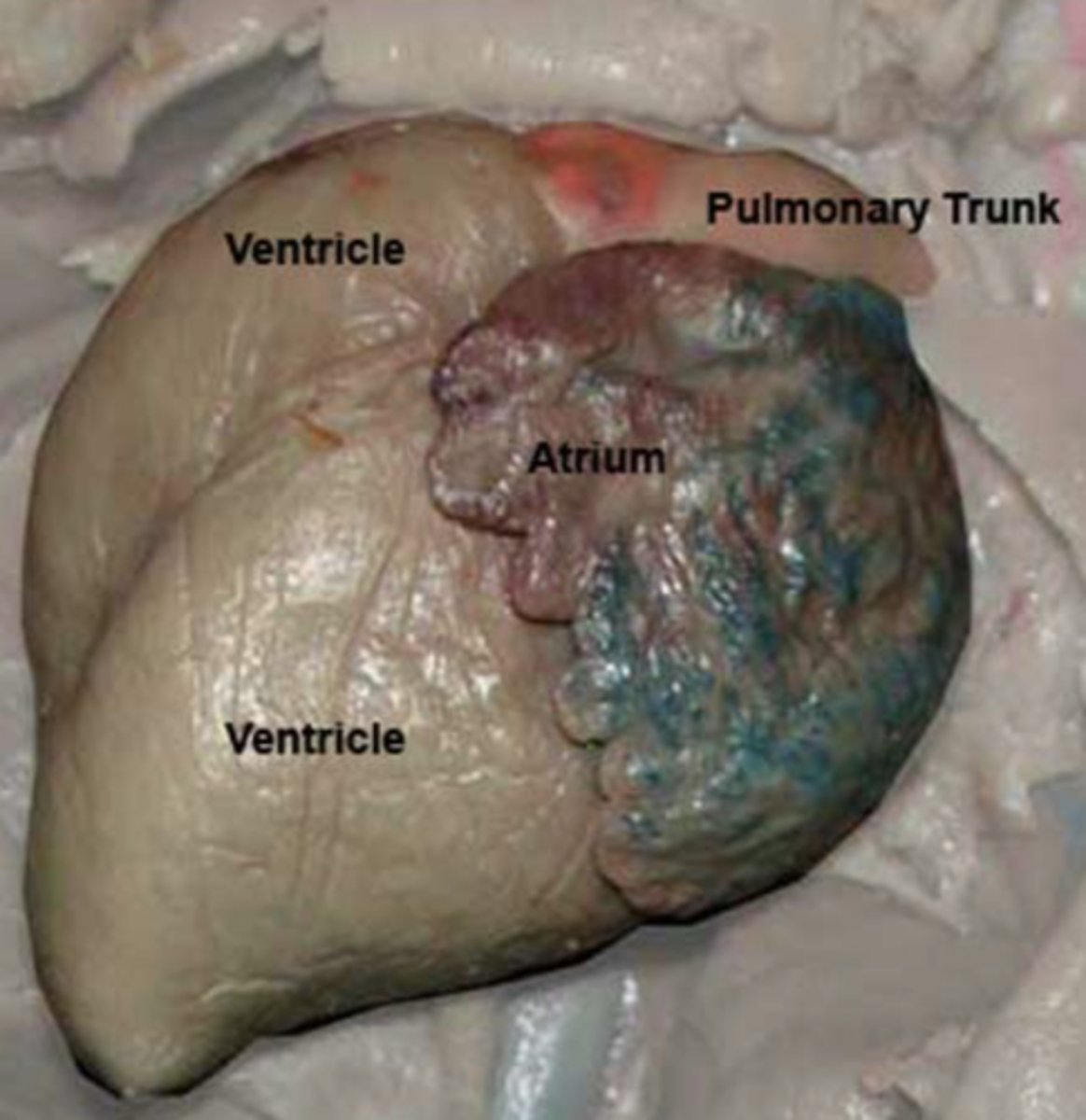 <p>Carries deoxygenated blood from right ventricle to pulmonary arteries — Large vessel exiting right ventricle anteriorly</p>