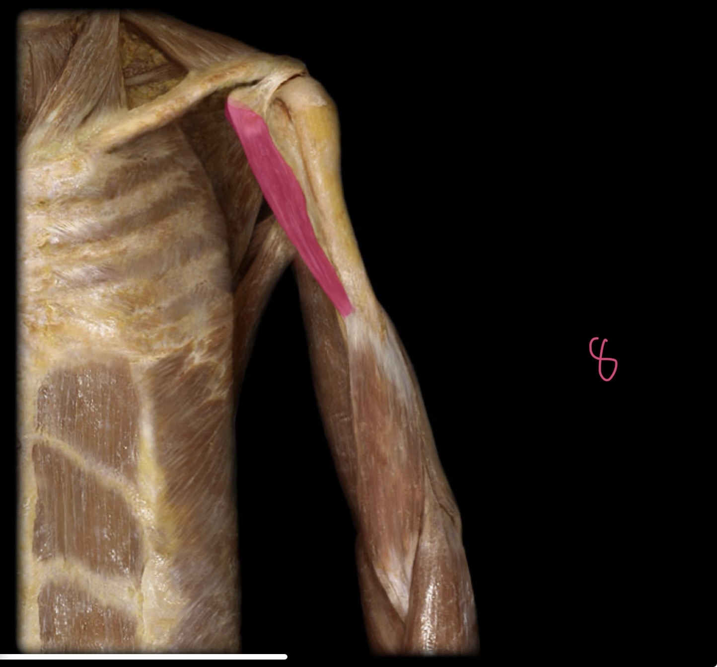 <p>Coracobrachialis m</p>