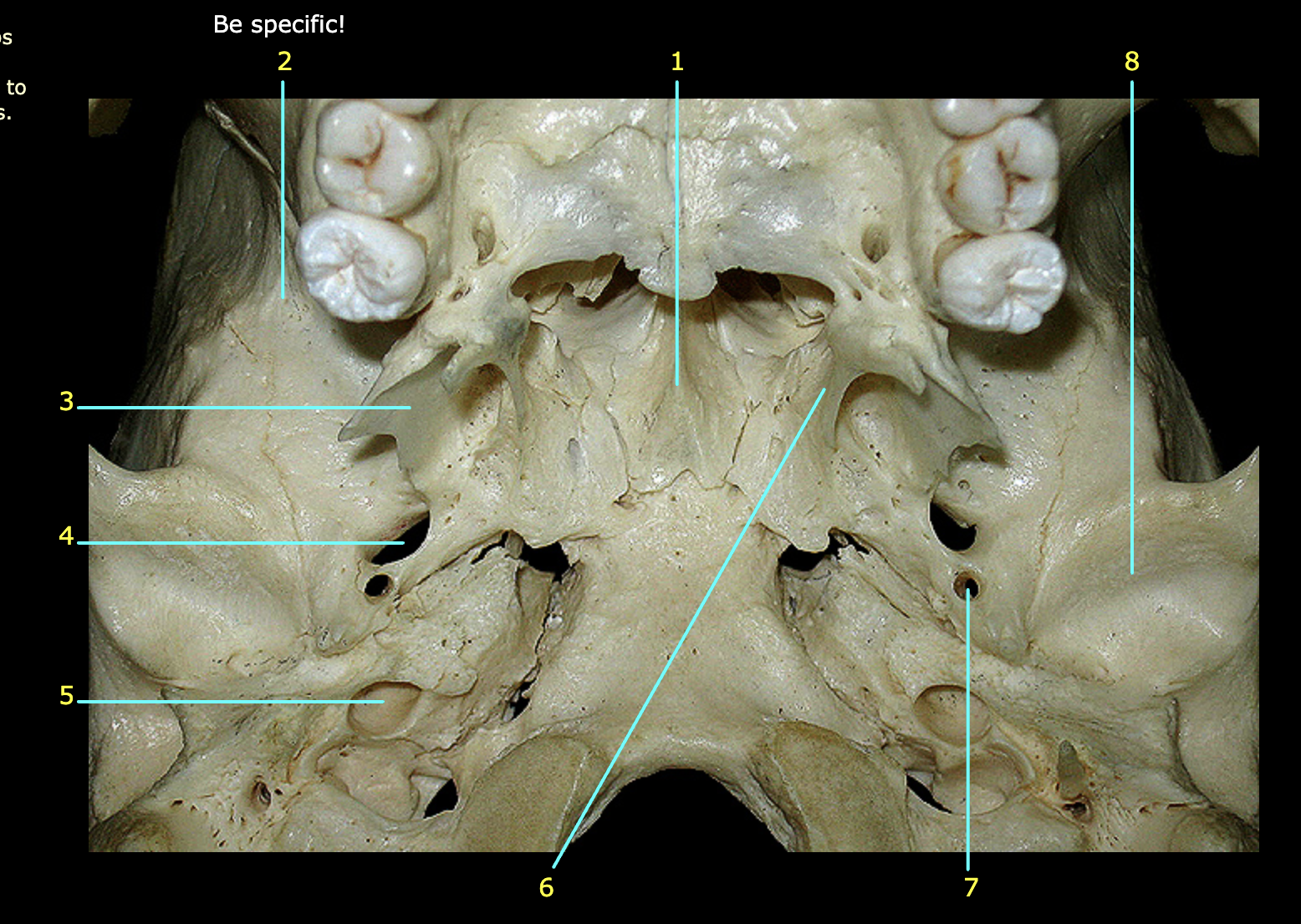 What structure is labeled 2?