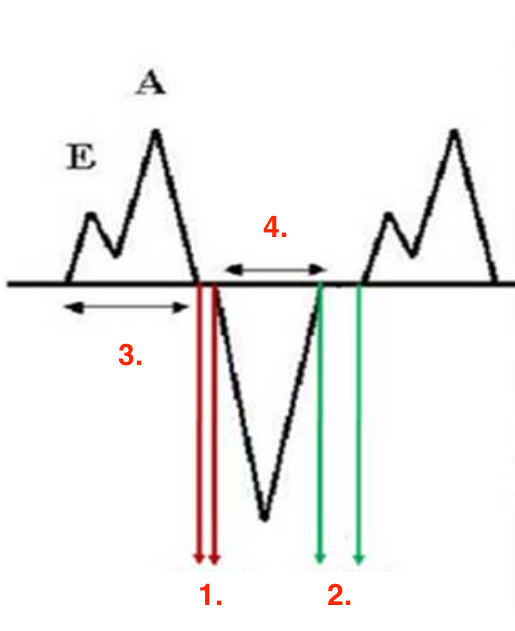 <p>Identify this image. </p>