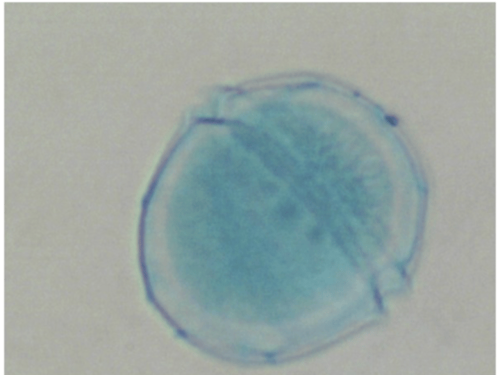 <p>What superphylum does Peridinium belong to?</p>