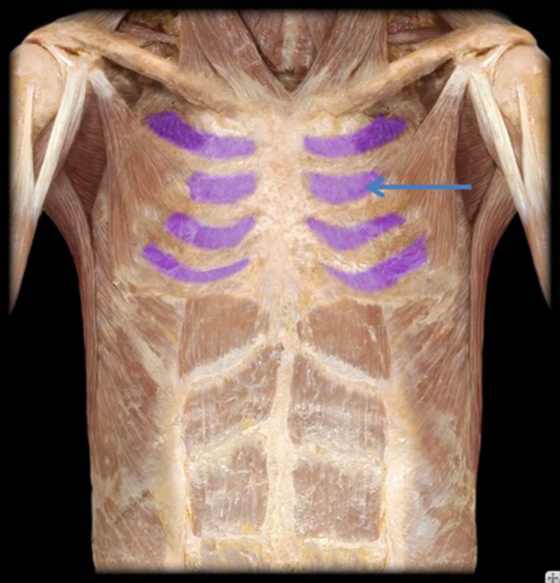 <p>What is the name of this muscle, highlighted in purple and indicated by the arrow?</p>