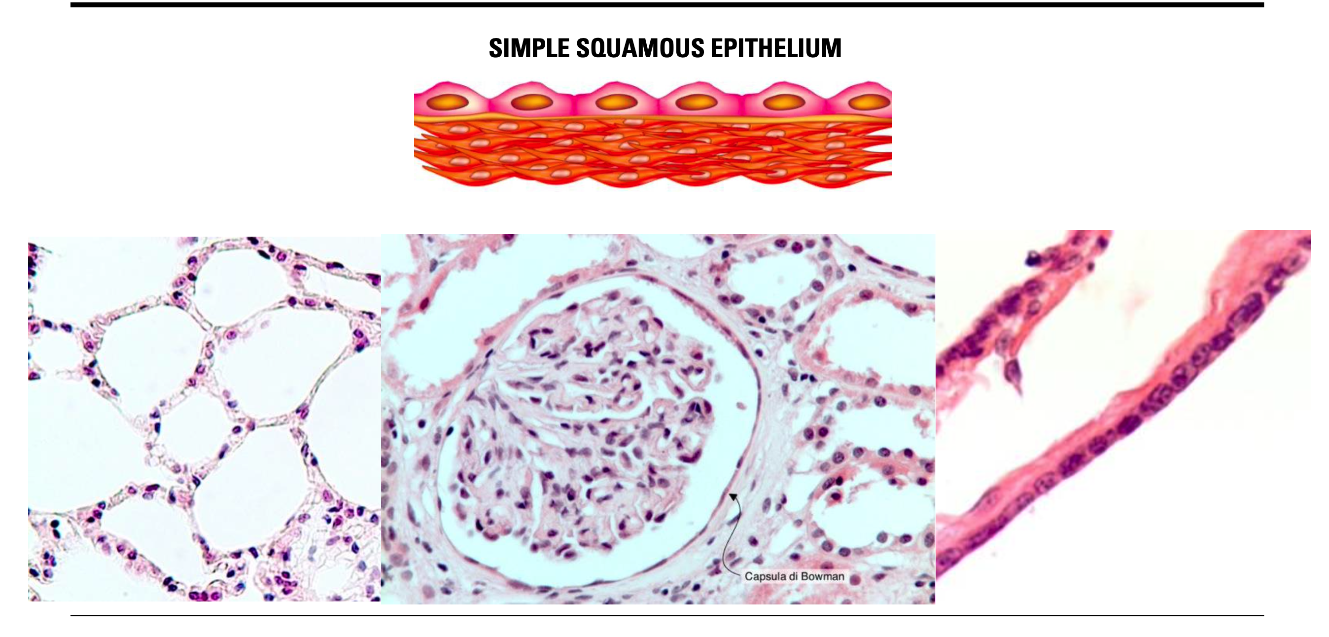 <p><span><strong>SIMPLE SQUAMOUS EPITHELIUM</strong></span></p>