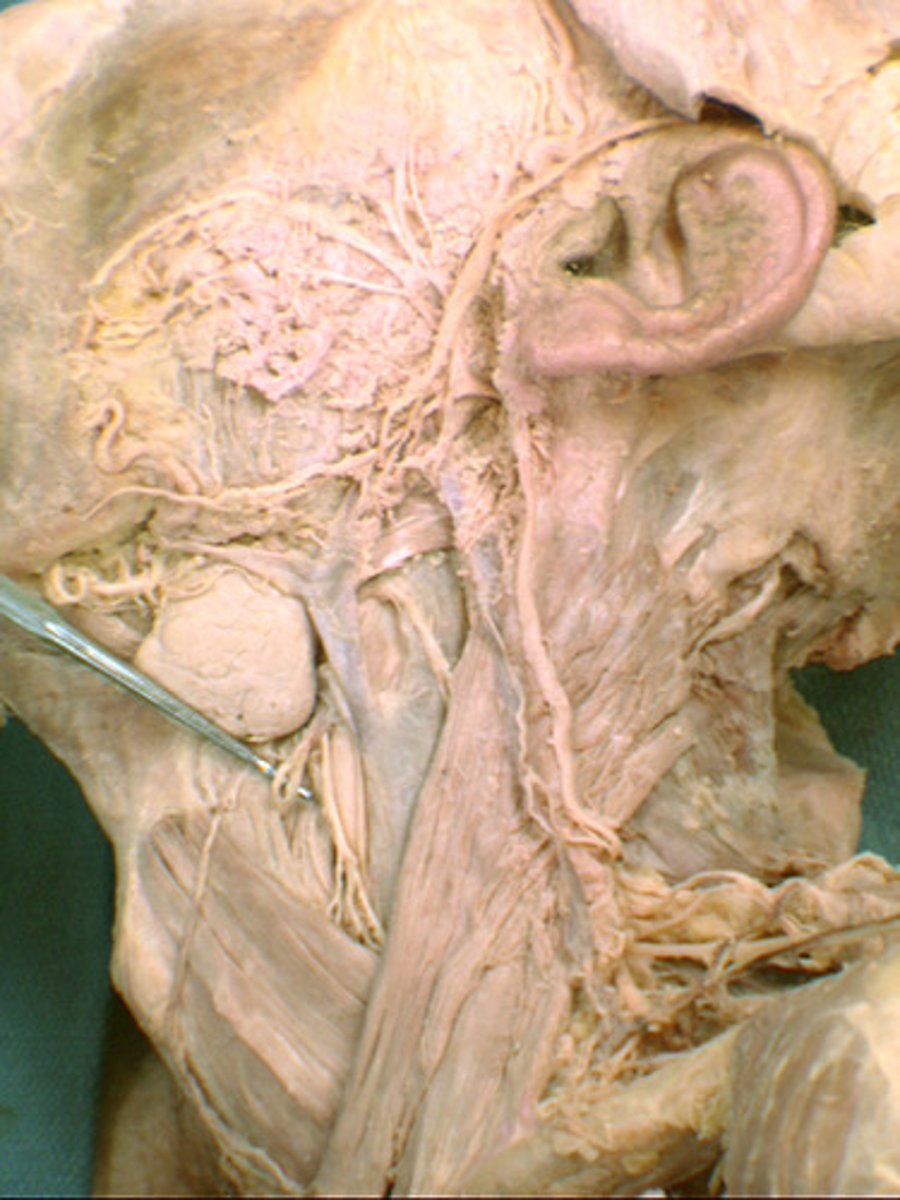 <p>Name the Nerve</p>