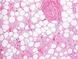 What cell structure is the photo and example of?