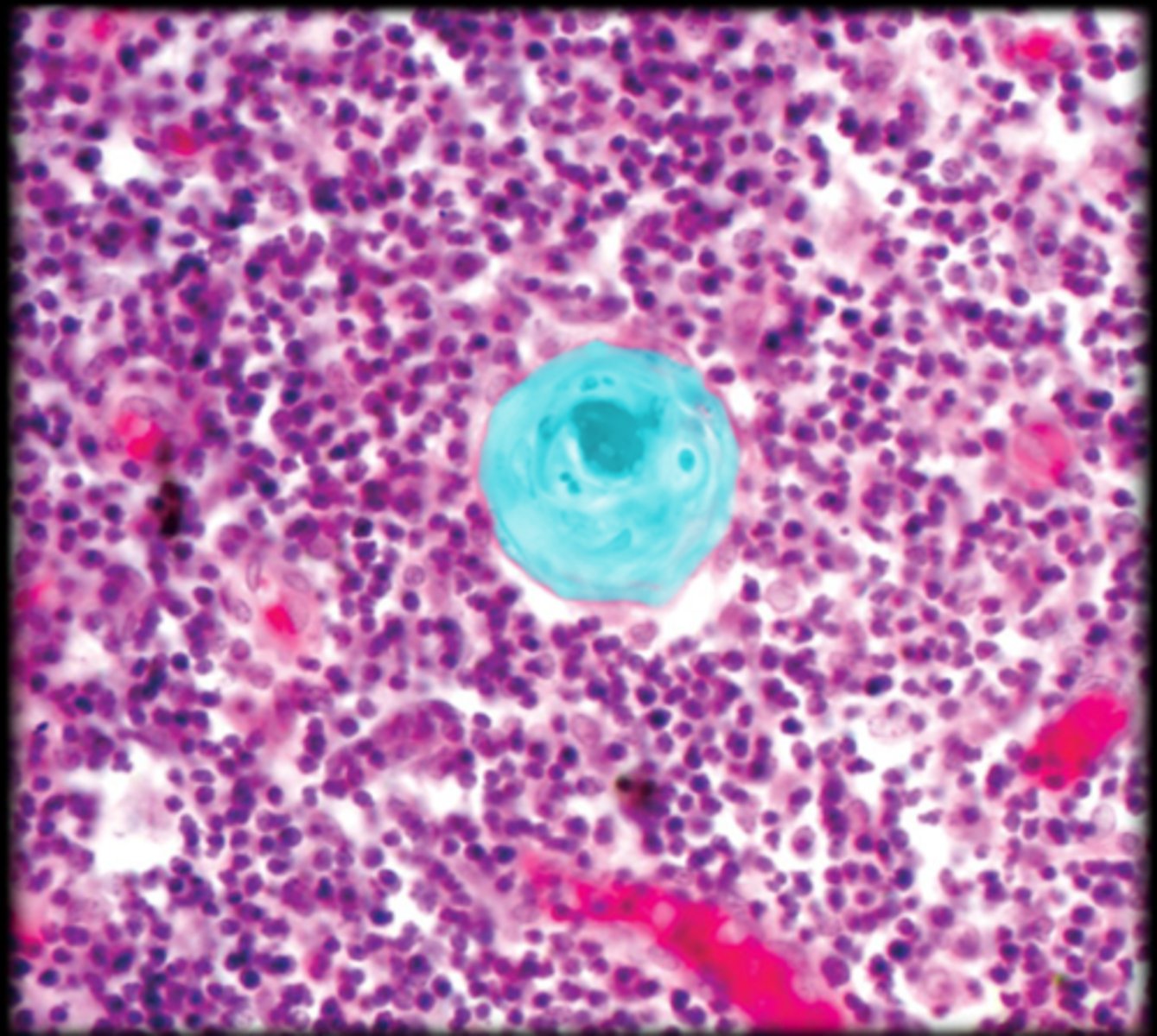 <p>Thymus</p>