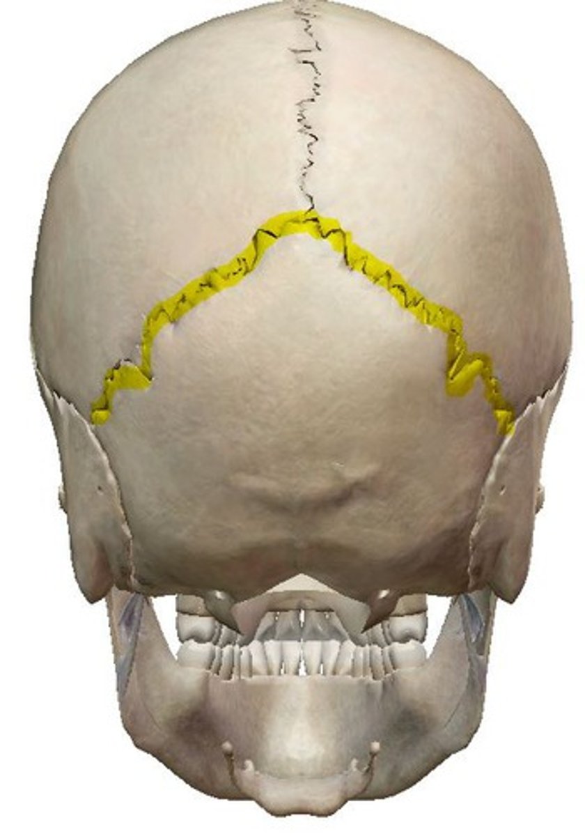 <p>ID highlighted joint</p>