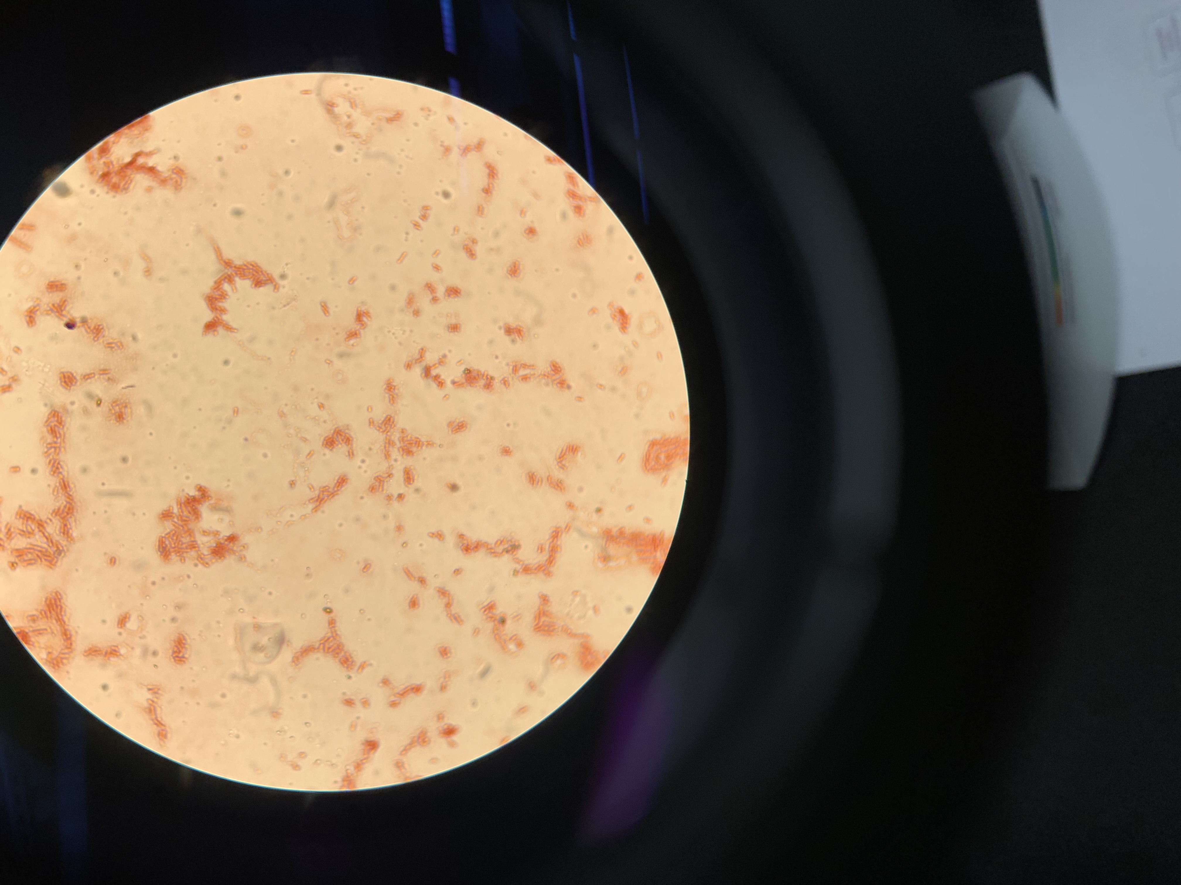 <p>what are the results of this gram stain</p>