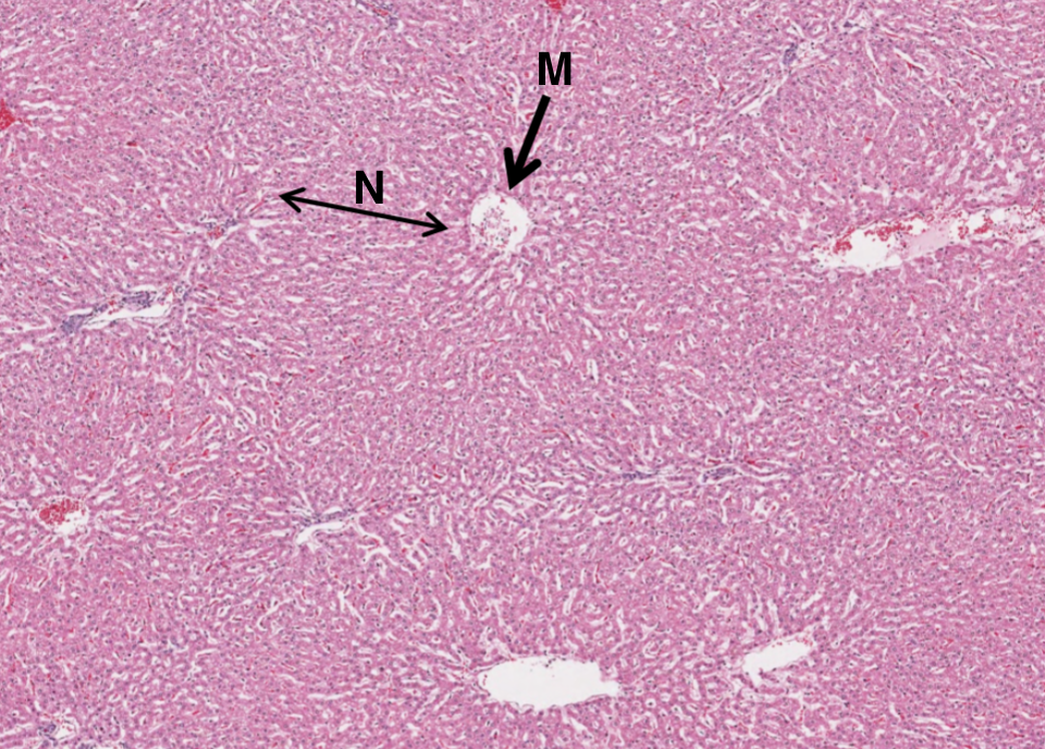 <p>What is N in this image of the liver?</p>