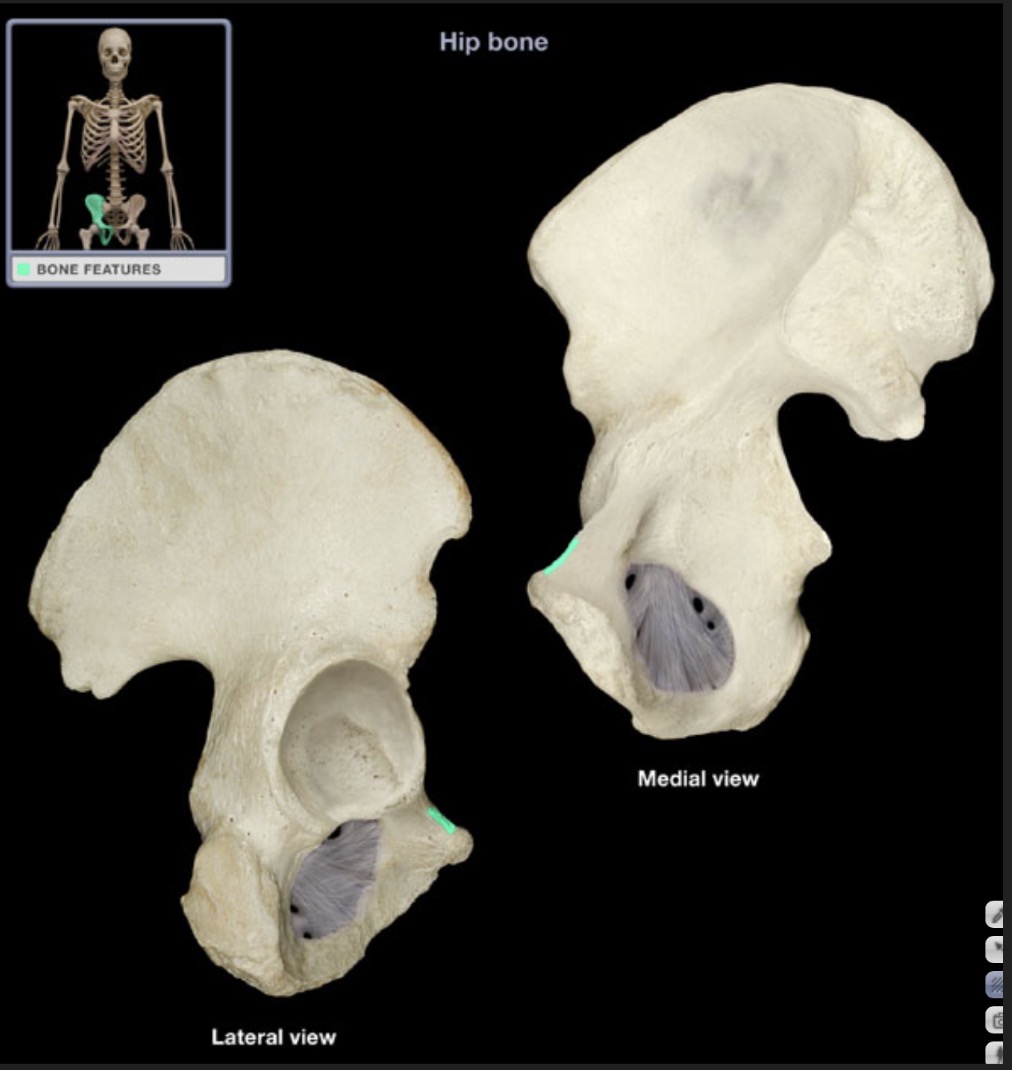 <p><span style="font-family: Arial, sans-serif; color: rgb(45, 59, 69)">ridge medial to the pubic tubercle that meets the pubic symphysis</span></p>