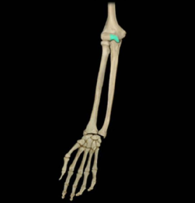 term image