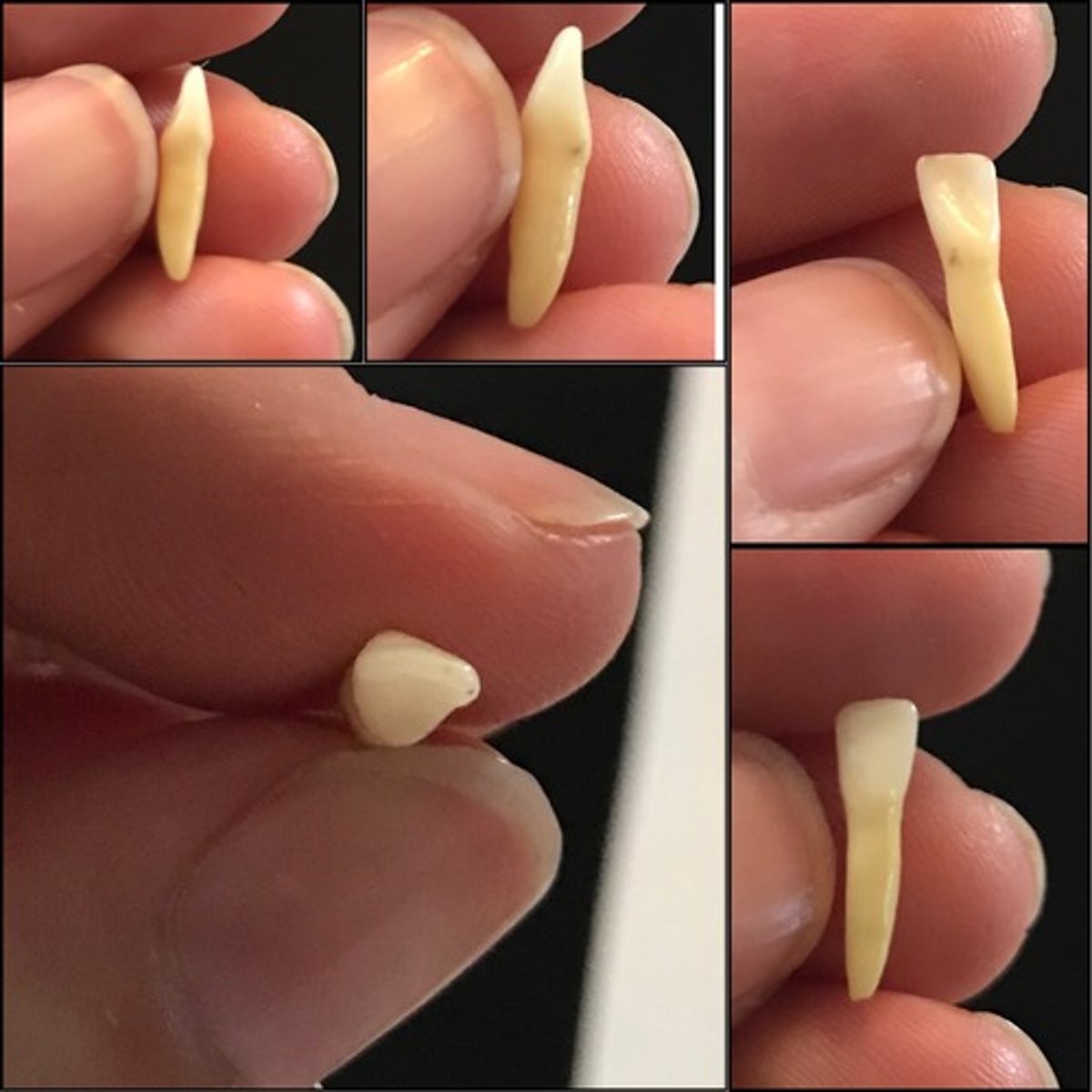 <p>What tooth is this ?</p>