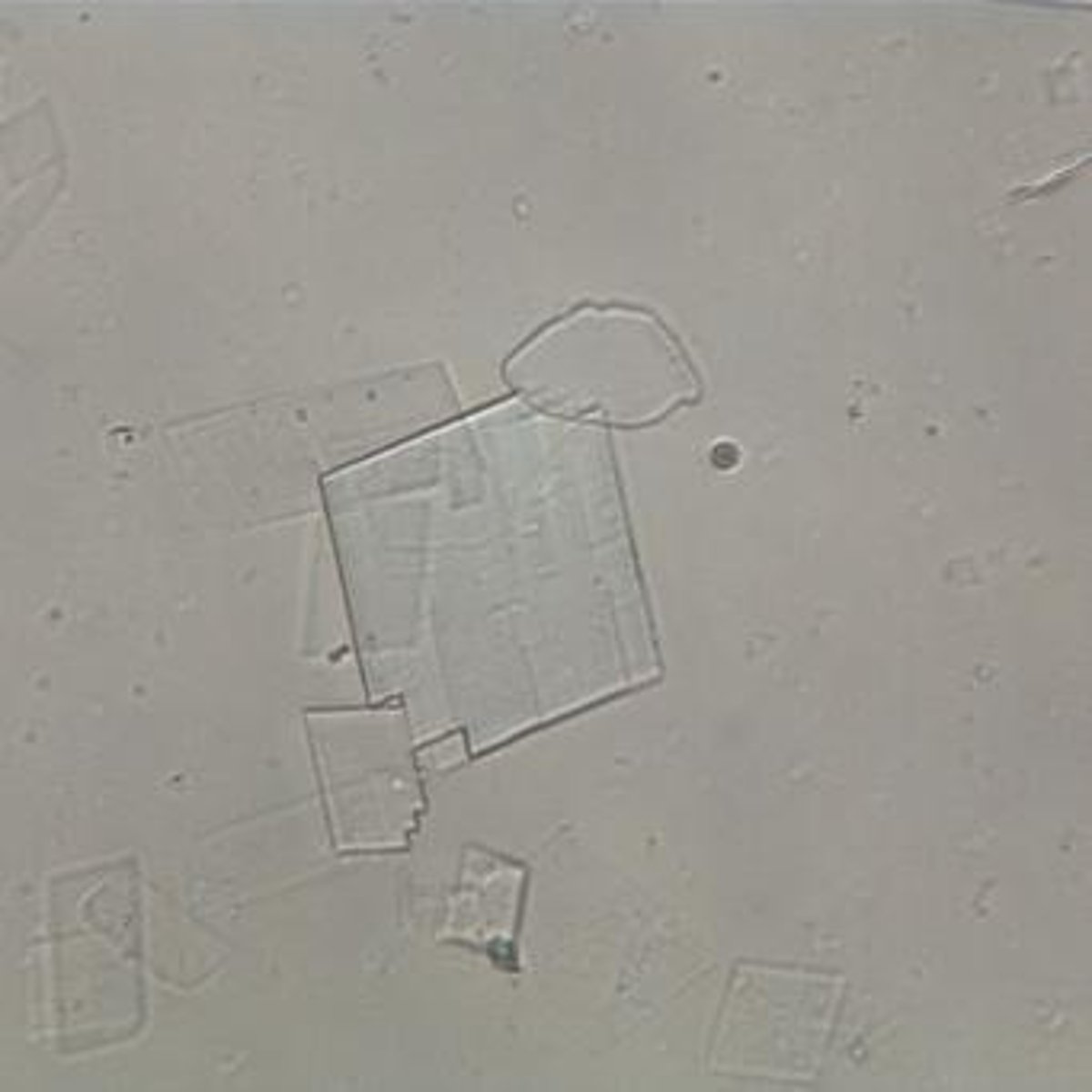 <p>Squamous, Transitional, Renal tubular, Oval fat body.</p>