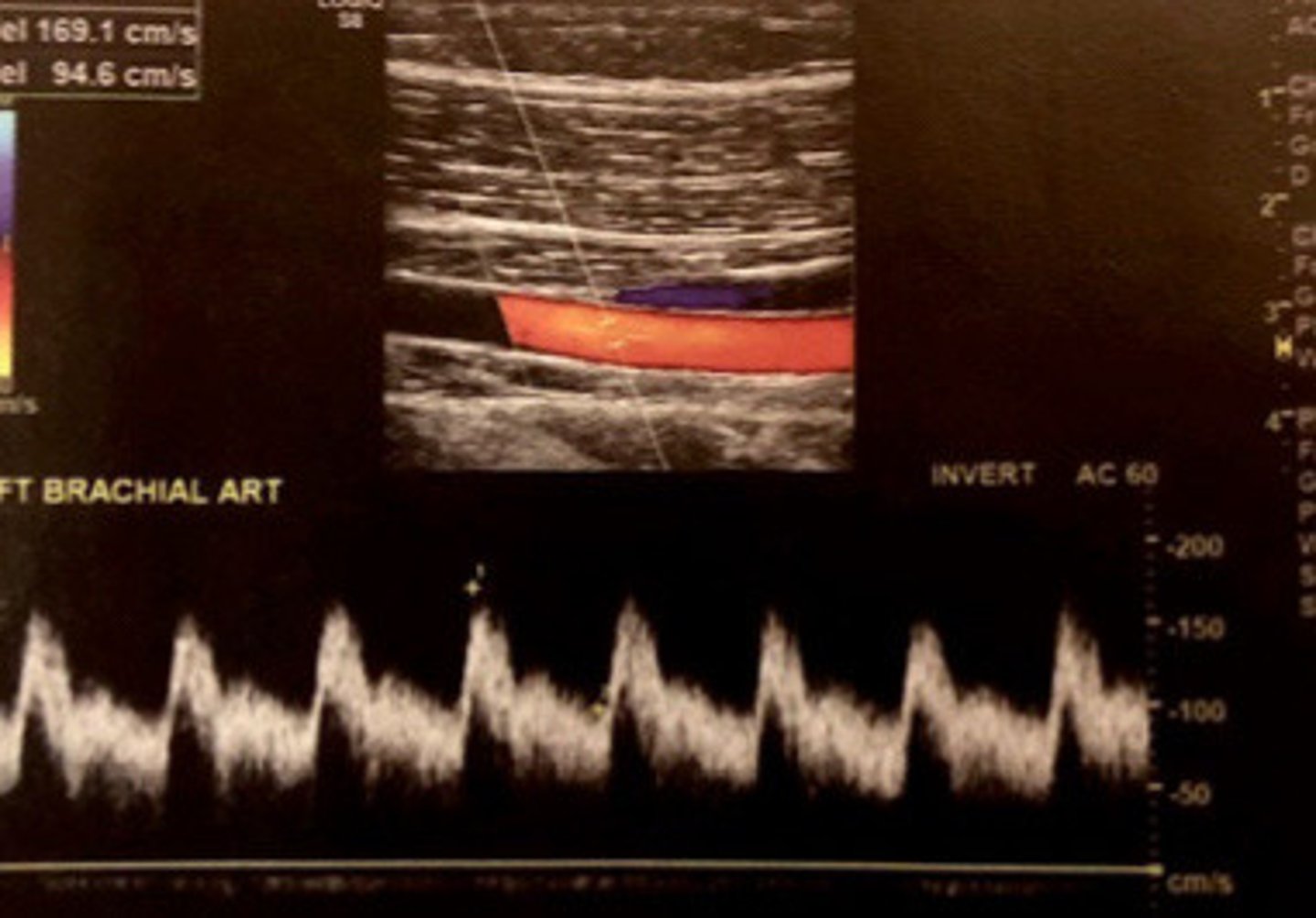 <p>What does this image show</p>