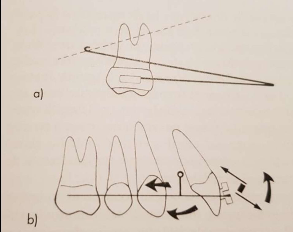 <p><strong>The force applied must pass through CR</strong>.</p><p class="has-focus">A) The only linear force, pass through CR</p><p class="has-focus">B) The sum of all forces applied pass through CR</p><p class="has-focus"></p>