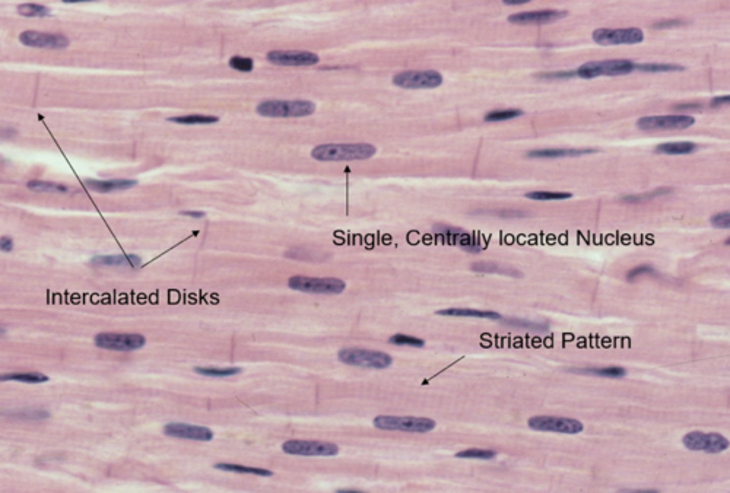 <p>Elongated, parallel fibers; multiple, peripheral nuclei (multinucleate); striations.</p>