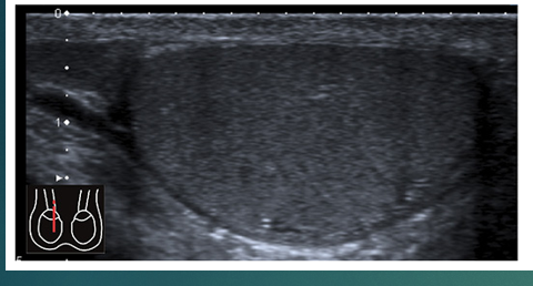 <p>List caudal, cranial, anterior and posterior</p>