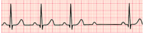 <p>What rhythm is this?</p>