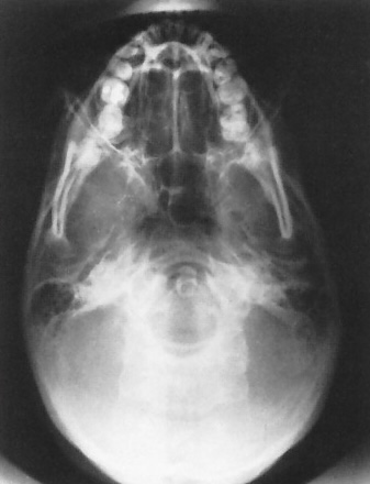 <p>What is this x-ray demonstrating?</p>