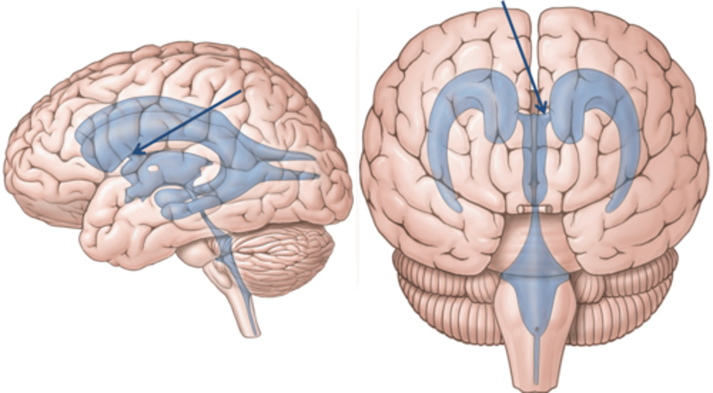 <p>connects lateral ventricles to third ventricle</p>