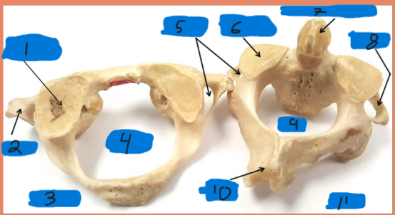 <p>what bone is on the right</p>