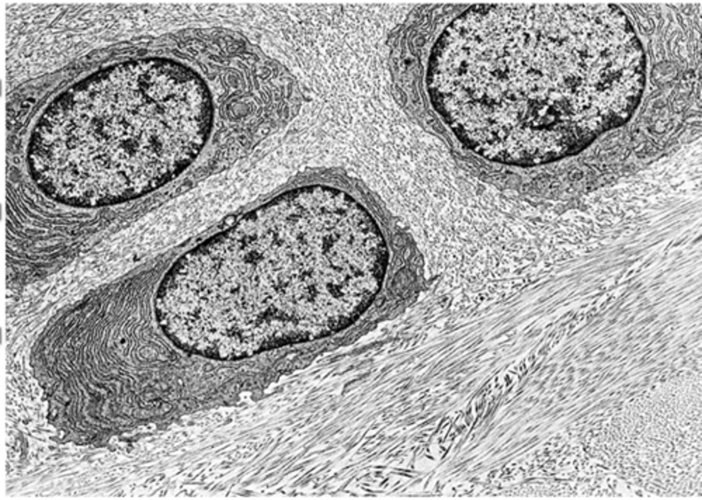 <p>How do active chondrocytes in growing cartilage appear under TEM?</p>