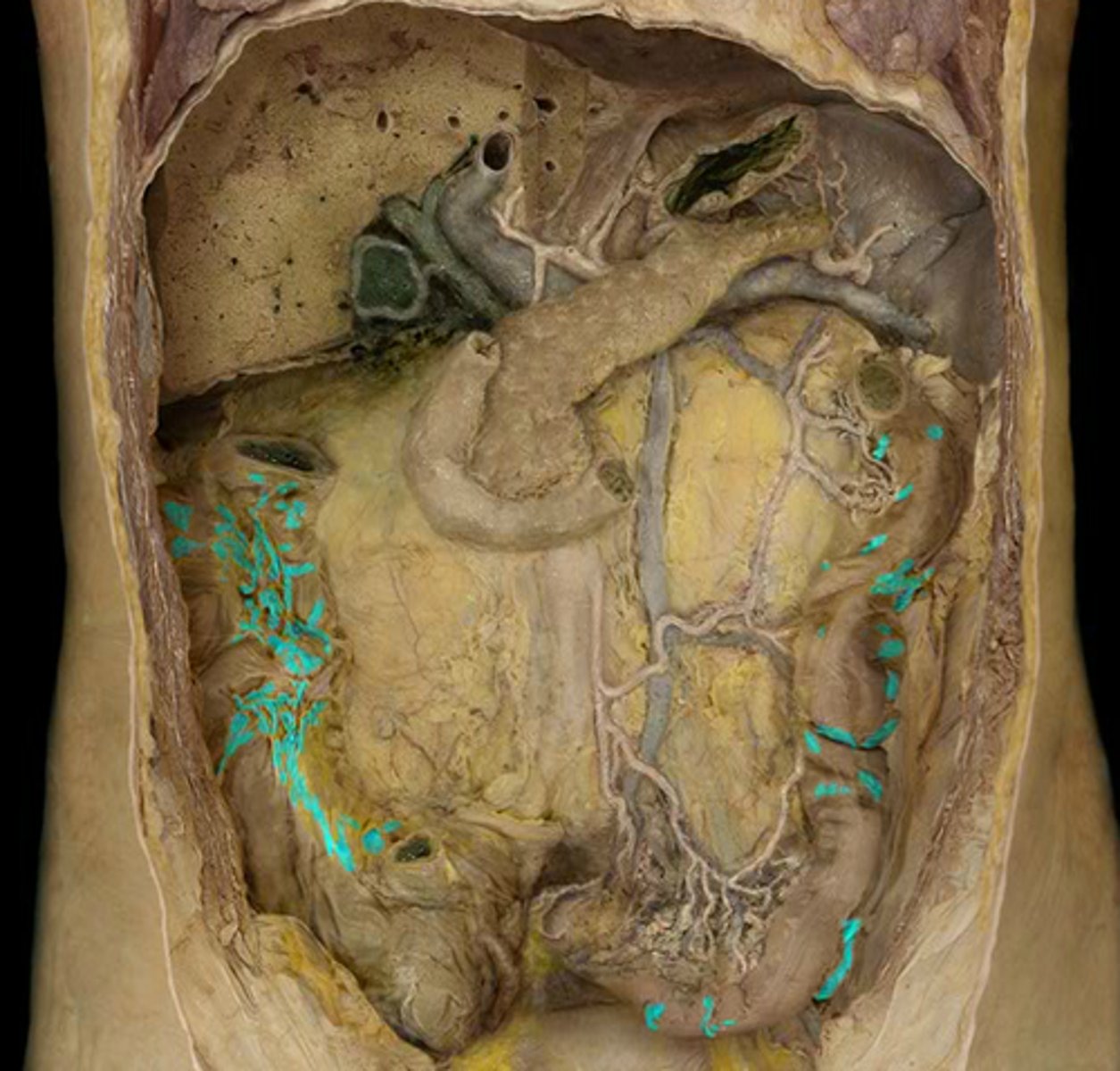 <p>Feature</p><p>- Fat parts hanging off the colon</p><p>- Shown on the right lateral side</p>