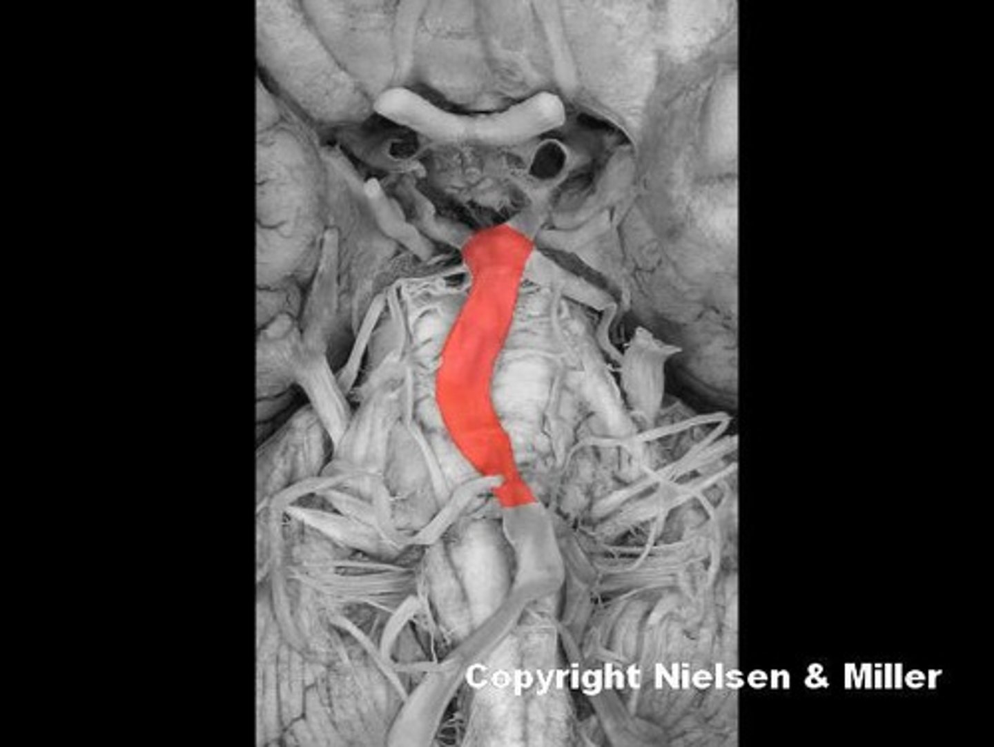 <p>Identify the regions supplied by the highlighted vessel (inferior view of base of brain)</p>