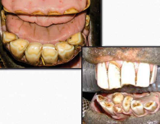 <p>What dental abnormality is this?</p>