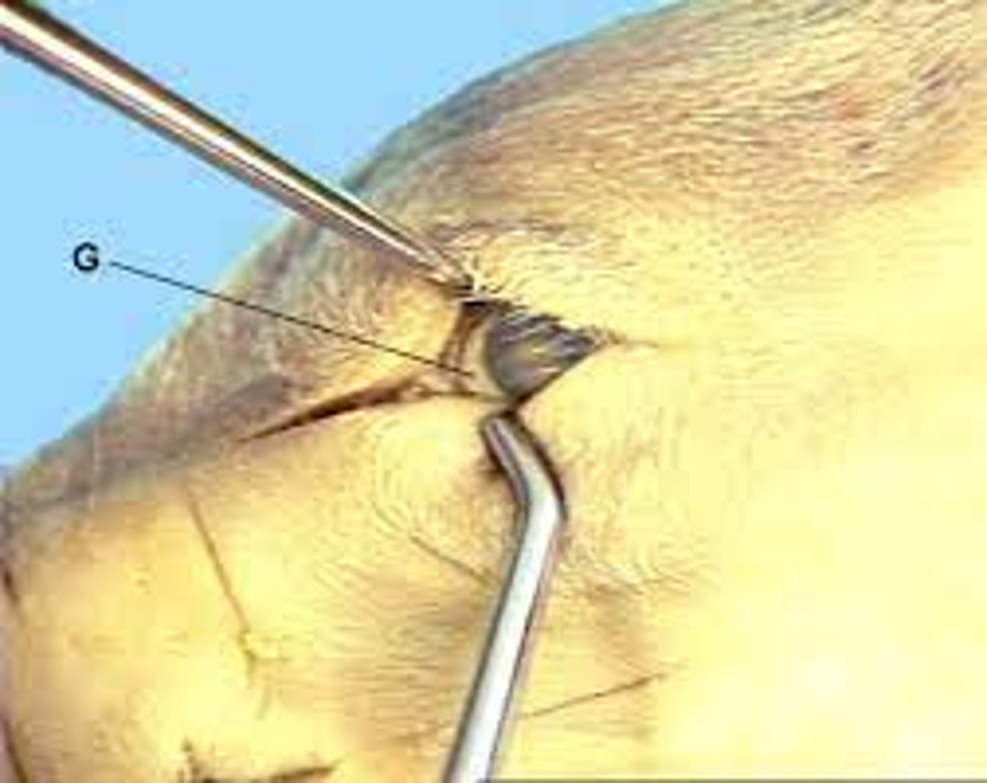 <p>Vestigial protective fold at medial corner of eye — Small pink membrane in inner corner of pig eye</p>