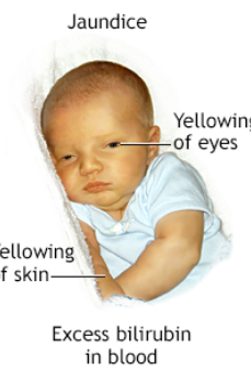 <p><span style="font-family: Droid Sans Mono, monospace">BILIRUBIN/O</span></p>