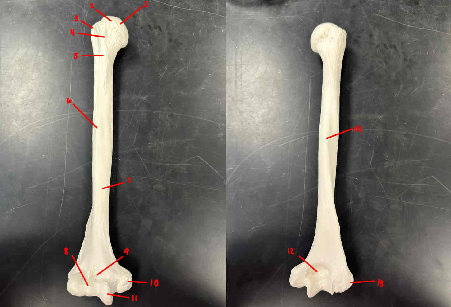 <p>what bone is this</p>