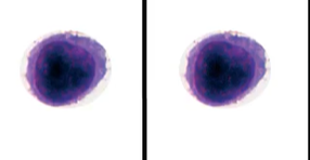 <p>B-cell, T-cell</p>