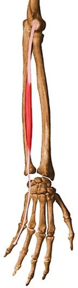 <p>What muscle is this?</p>