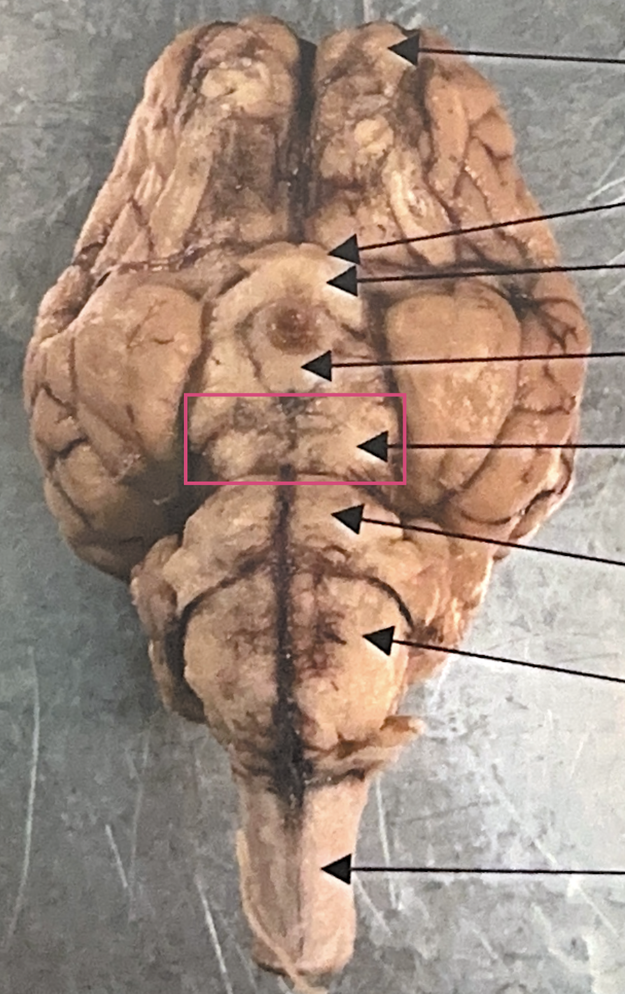 <p>What is this highlighted figure?</p>