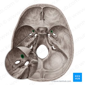 in sphenoid bone