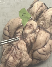 <p>What does letter F represent on the brain?</p>